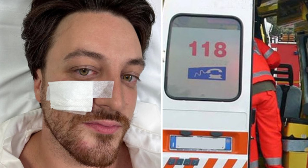 alberto stefani coinvolto in un incidente stradale a treviglio il presidente del veneto in ospedale far242 di tutto per essere al lavoro domani da Ilgazzettino.it alberto stefani coinvolto in un incidente stradale a treviglio il presidente del veneto in ospedale far242 di tutto per essere al lavoro domani