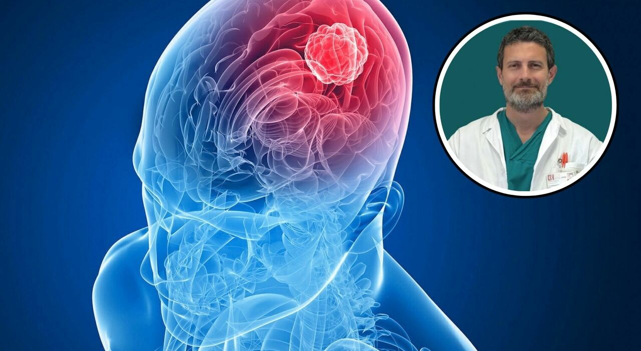 Brain Tumors: Key Symptoms, Warning Signs, and Treatments