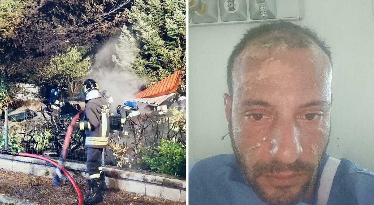 michael carboni ustionato e sotto choc ero pieno di sangue mi ha soccorso un medico in pensione da Corriereadriatico.it michael carboni ustionato e sotto choc ero pieno di sangue mi ha soccorso un medico in pensione