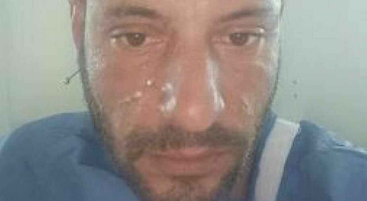 esplosione nella casa mobile su ruote a pieve torina dimesso michael carboni il giovane operaio ustionato da Corriereadriatico.it esplosione nella casa mobile su ruote a pieve torina dimesso michael carboni il giovane operaio ustionato