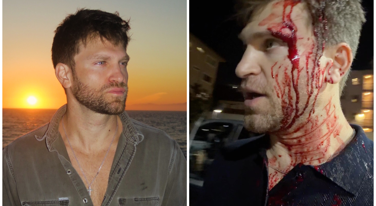 https://statics.cedscdn.it/photos/MED_HIGH/2026/10/12/9820130_12151627_keegan_allen_picchiato_rapinato_los_angeles_cosa_e_successo.jpg