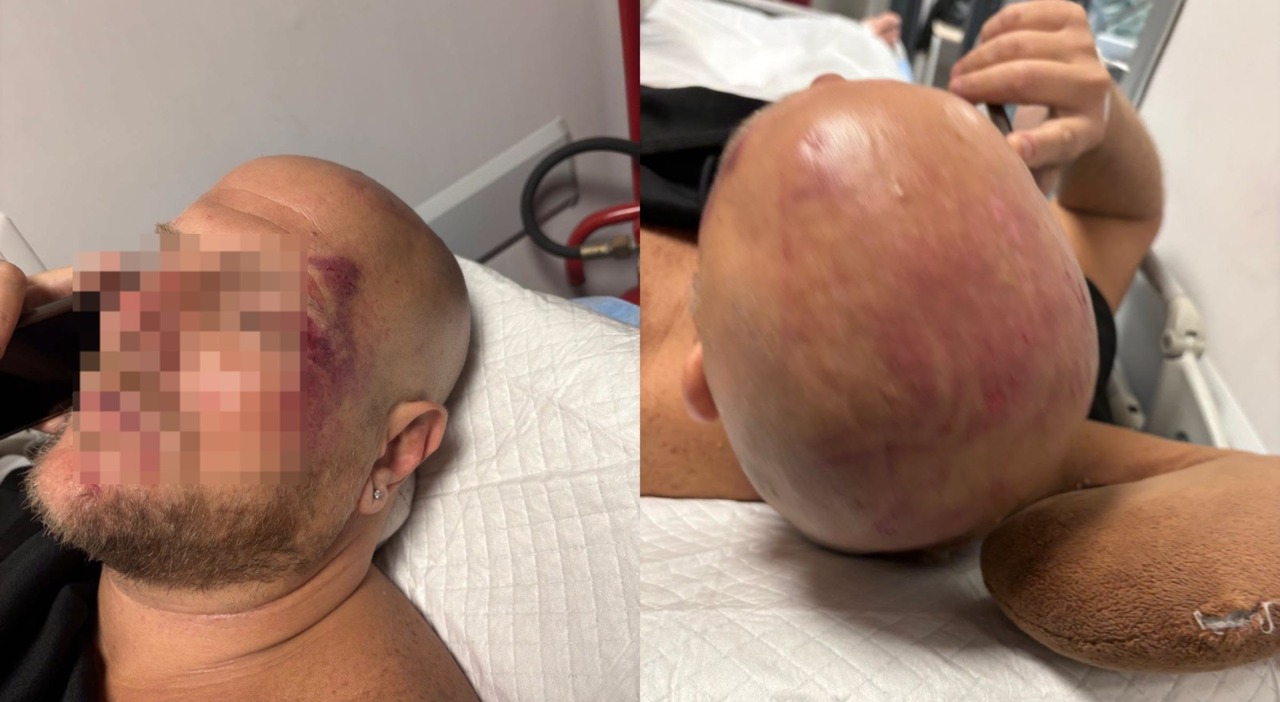 napoli aggredito dal branco al vomero commenti choc sui social vieni picchiato davanti alle tue figlie che padre sei da Ilmattino.it napoli aggredito dal branco al vomero commenti choc sui social vieni picchiato davanti alle tue figlie che padre sei