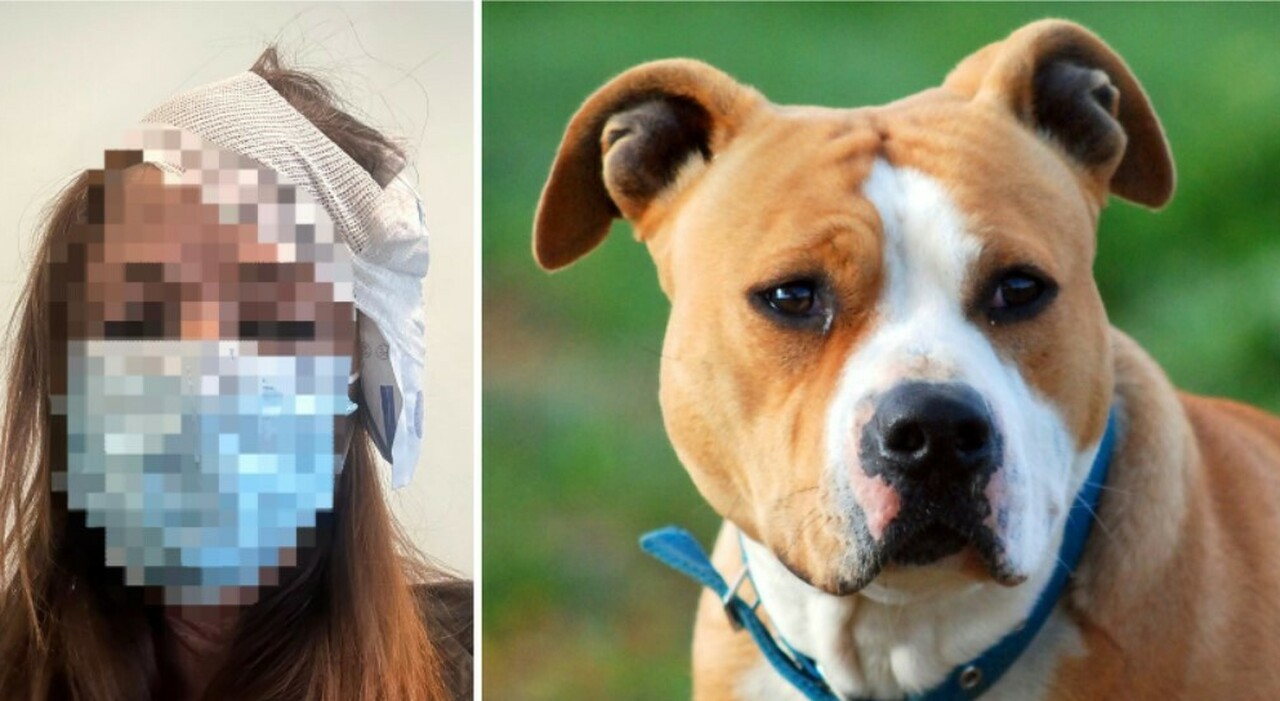 azzannata alla testa da un cane amstaff mentre 232 al tavolino del bar la dog sitter poi 232 scappata da Ilgazzettino.it azzannata alla testa da un cane amstaff mentre 232 al tavolino del bar la dog sitter poi 232 scappata