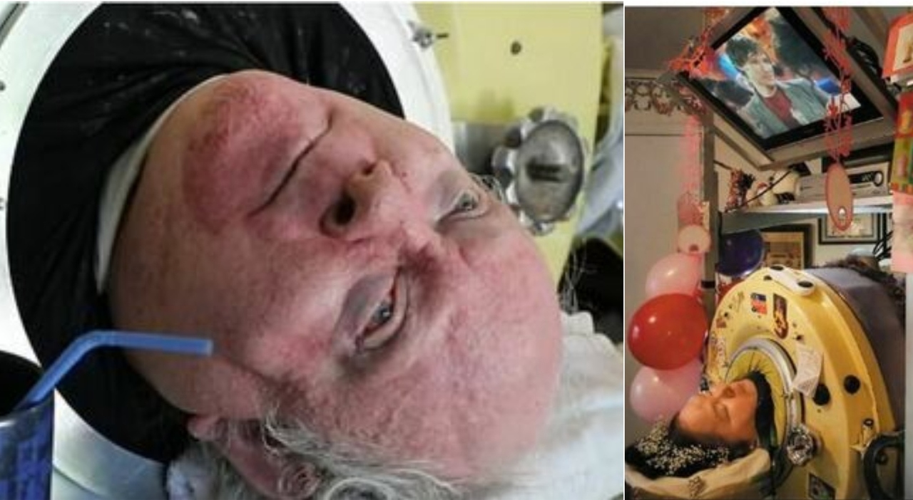Paul Alexander, l'homme qui a vécu 70 ans dans un 'poumon d'acier'
