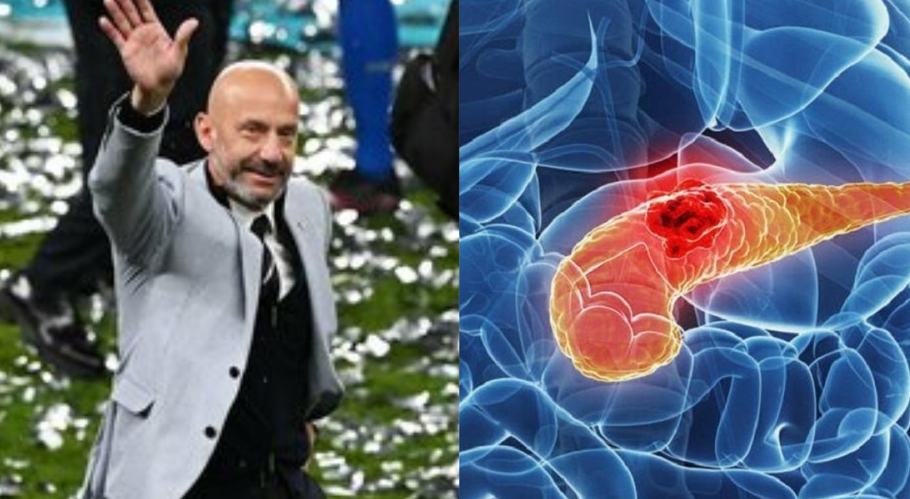 Gianluca Vialli morto per il tumore al pancreas. «È il cancro più letale»:  sintomi e cure