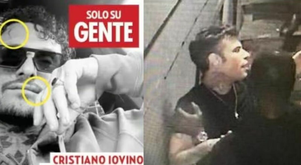 Fedez, il video della rissa con Iovino alla discoteca The Club di Milano: la foto del personal trainer con le ...