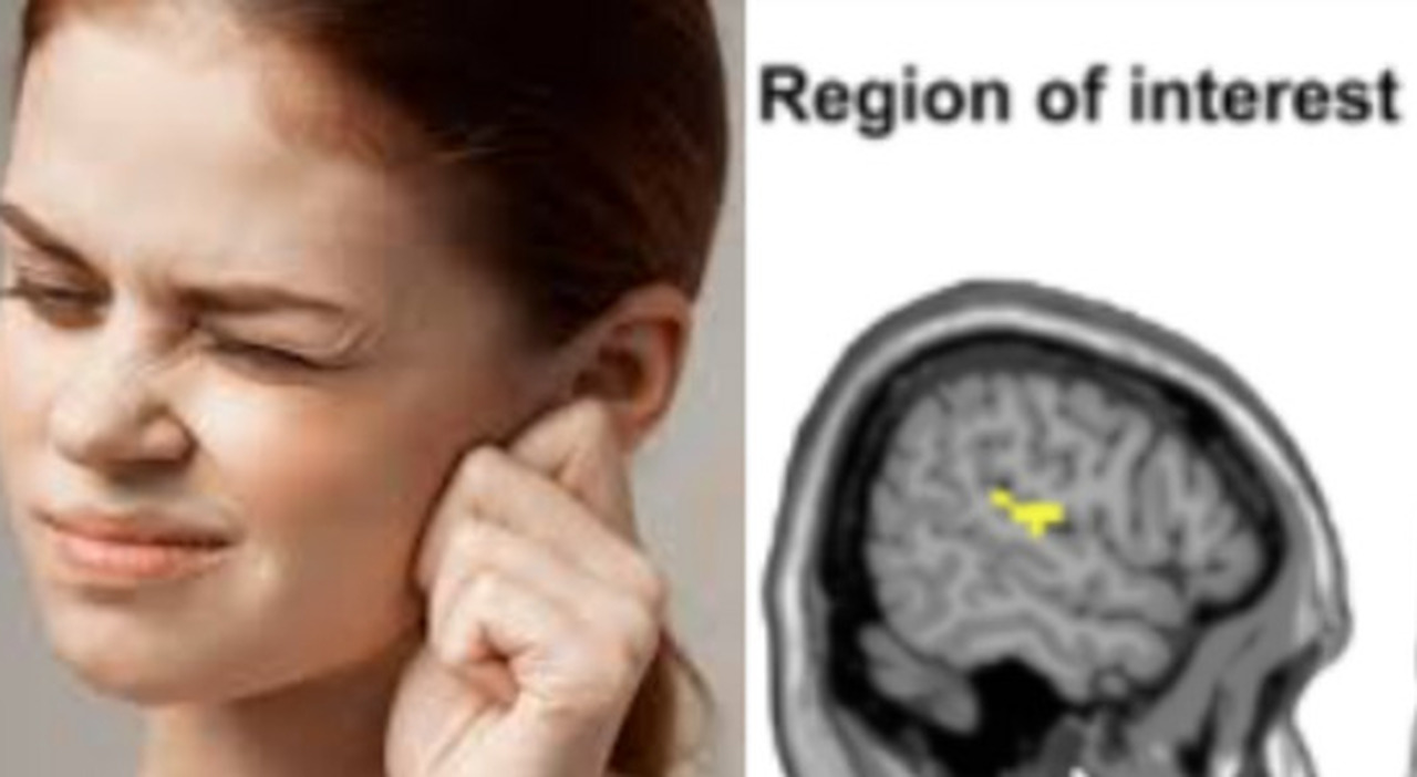 Tor Vergata University study presented for the treatment of «tinnitus» - Breaking Latest News