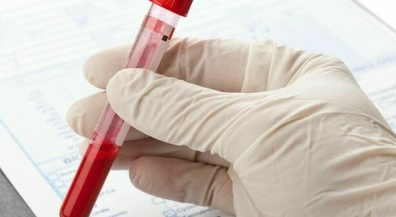 transfusion method to exchange diseased blood with wholesome blood