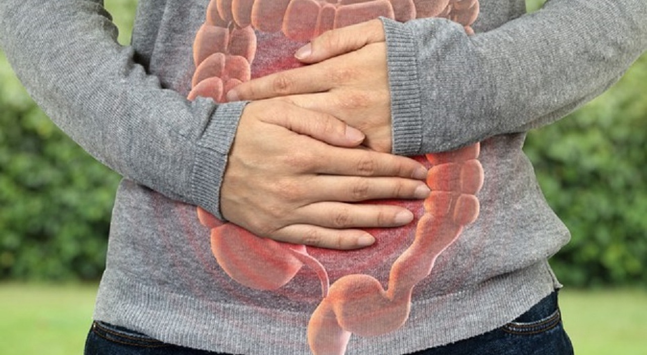 Colorectal cancer cases are on the rise among young people. The latest ...