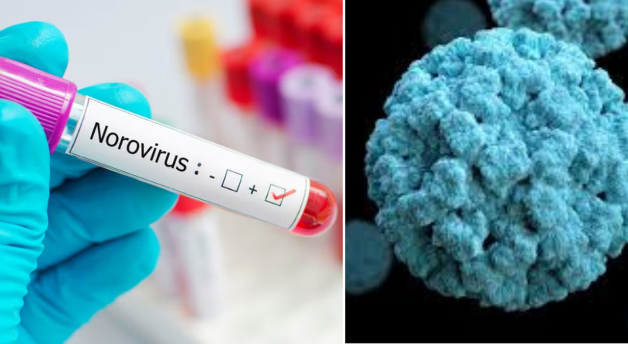 Norovirus tra 