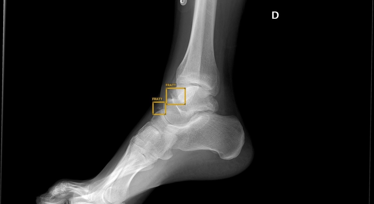 Virtual Assistant Radiology AI-Powered Virtual Radiology Assistant Enhances Emergency Diagnostics ...