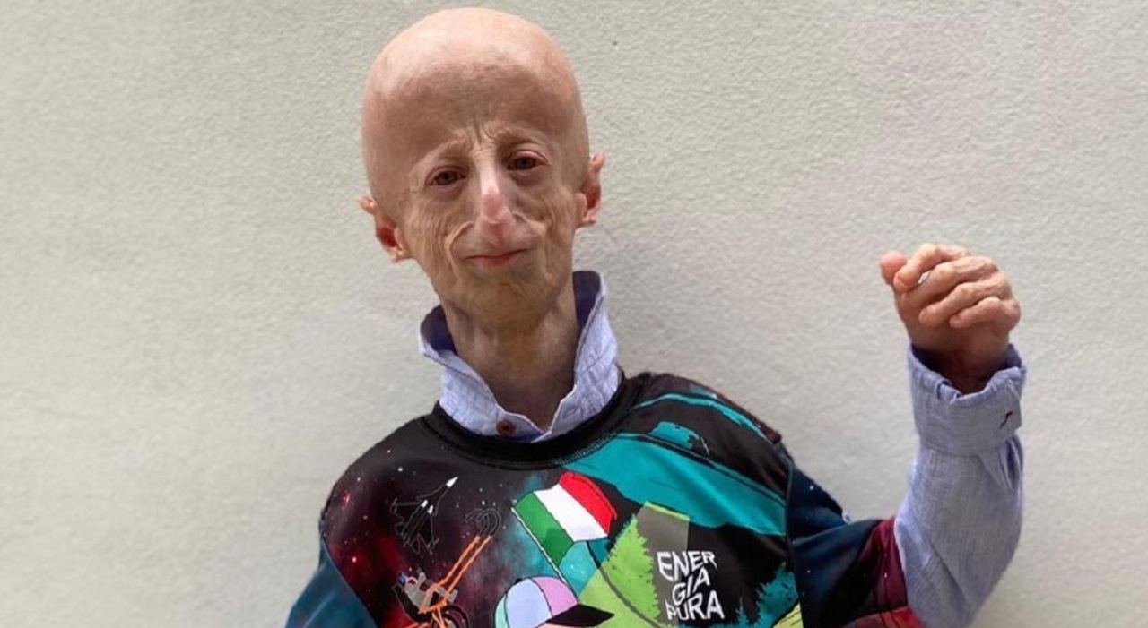 Sammy Basso morto a 28 anni, era il malato di progeria più longevo al mondo. Il malore al ristorante dopo il premio