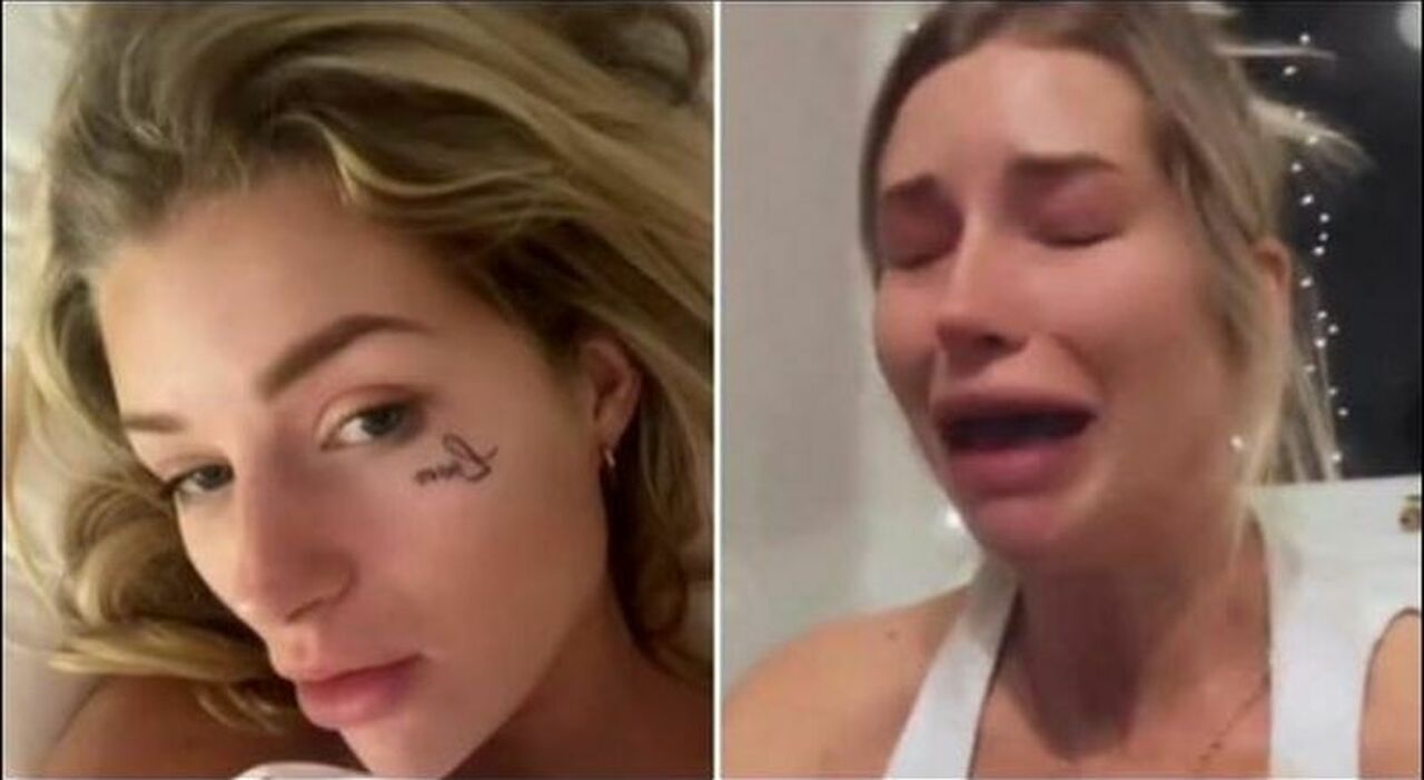 Kate Moss, la sorella Lottie si tatua il viso dopo una serata alcolica, il video appena sveglia «Potevo evitarlo»