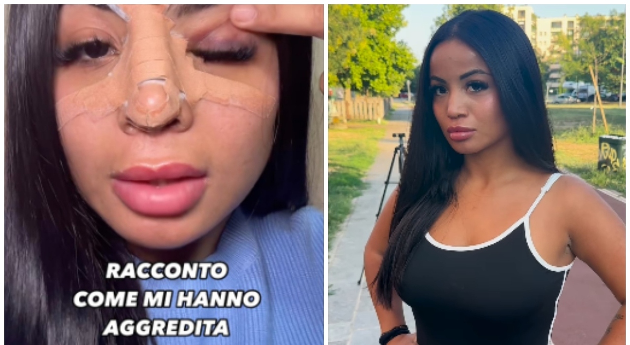 Manuela Bassani, la star di OnlyFans picchiata in strada a Milano dopo il  «no» a un selfie: «Insultata e sbattuta contro un palo»