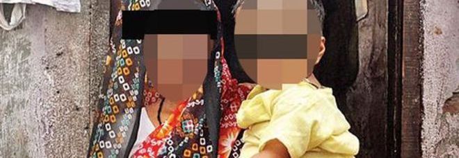 Bimbo nasce con tre organi genitali, i medici:
"Abbiamo rimossi quelli in eccesso"