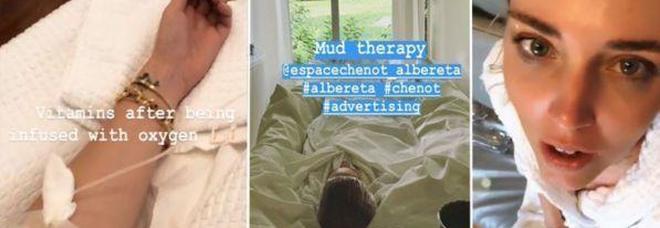 Massaggi, allenamento e flebo di vitamine: il week end di relax di Chiara Ferragni senza Fedez