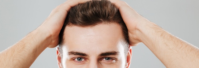 Calvizie: autotrapianto dei capelli e altre tecniche per porre rimedio