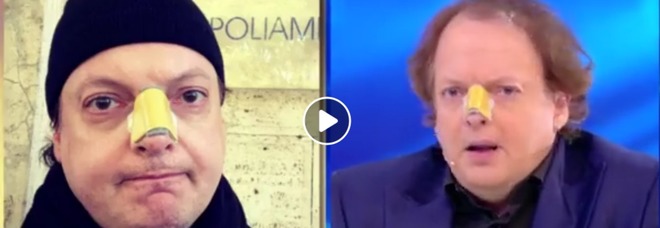 Dado, il comico aggredito dall'ex della figlia: «Ho scelto di denunciare ma ora sono preoccupato» Video Dado, il comico aggredito dall'ex della figlia: «Ho scelto di denunciare ma ora sono preoccupato» Video