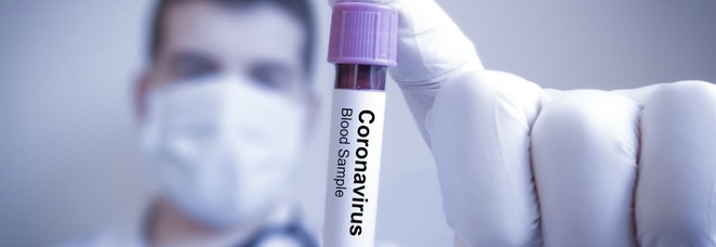 Coronavirus, allarme Marsica: salgono a 19 i contagi a Celano Coronavirus, allarme Marsica: salgono a 19 i contagi a Celano