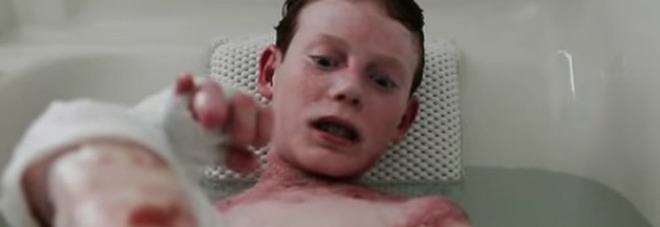 Il bambino farfalla, Jonathan Pitre, non ce l'ha fatta: morto all'eta di 17 anni (Youtube) Il bambino farfalla, Jonathan Pitre, non ce l'ha fatta: morto all'eta di 17 anni (Youtube)
