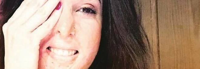 Gessica Notaro un anno dopo l'attacco con l'acido: Gessica Notaro un anno dopo l'attacco con l'acido: