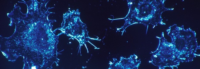 Tumori, scoperta la proteina che li aiuta a nutrirsi: la ricerca dell'università di Pisa Tumori, scoperta la proteina che li aiuta a nutrirsi: la ricerca dell'università di Pisa