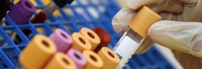 Lei gli confessa di avere l'Hiv dopo 6 mesi di relazione: «Controlli continui» Lei gli confessa di avere l'Hiv dopo 6 mesi di relazione: «Controlli continui»