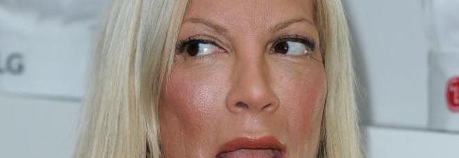 Tori Spelling, il volto è deformato dal botox: irriconoscibile all'evento in California
