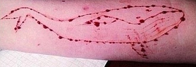 Torna l'allarme Blue Whale, 20enne trovata con tagli al braccio: si indaga per istigazione al suicidio Torna l'allarme Blue Whale, 20enne trovata con tagli al braccio: si indaga per istigazione al suicidio