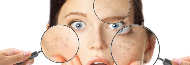 Imperfezioni estetiche
e imbarazzo: quando
la pelle è fonte di ansia