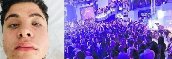 Difende un'amica in disco: seguito e pestato a sangue nel parcheggio Difende un'amica in disco: seguito e pestato a sangue nel parcheggio