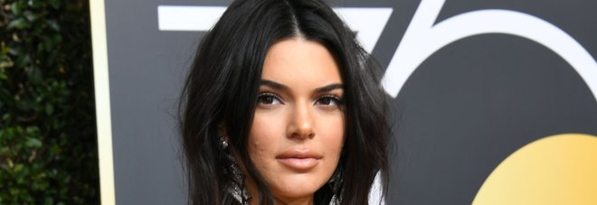Kendall Jenner sul red carpet con l'acne: e lei mette a tacere gli haters