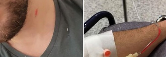 Roma, studente bocciato all'Itis: il papà picchia a sangue il giovane prof 23enne Foto choc Roma, studente bocciato all'Itis: il papà picchia a sangue il giovane prof 23enne Foto choc