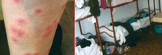 B&B abusivo in centro con sei turisti devastati dalle "cimici dei letti"