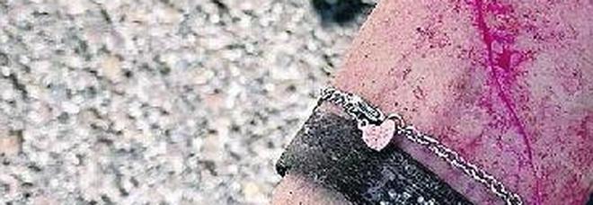 La ragazza si è ferita strappando il coltello dalle mani del rapinatore La ragazza si è ferita strappando il coltello dalle mani del rapinatore