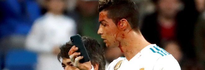 Ronaldo segna di testa ma si ferisce: selfie per controllare i danni