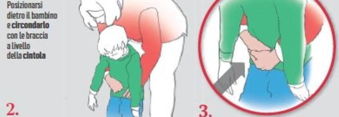 Manovra di Heimlich, cos'è e come si fa la mossa che ha salvato la vita al cliente del ristorante