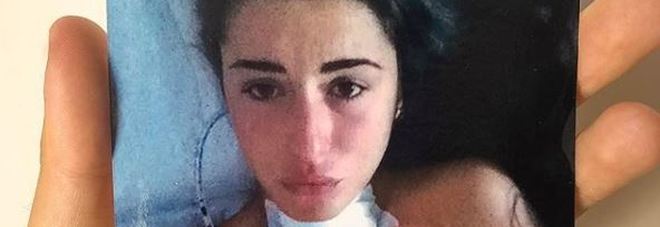 Valentina Vignali: «Così ho sconfitto il cancro, lottate insieme a me» Valentina Vignali: «Così ho sconfitto il cancro, lottate insieme a me»