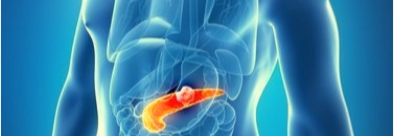 Tumore al pancreas, nuova cura aumenta la sopravvivenza: cancro eliminato in oltre il 20% dei casi