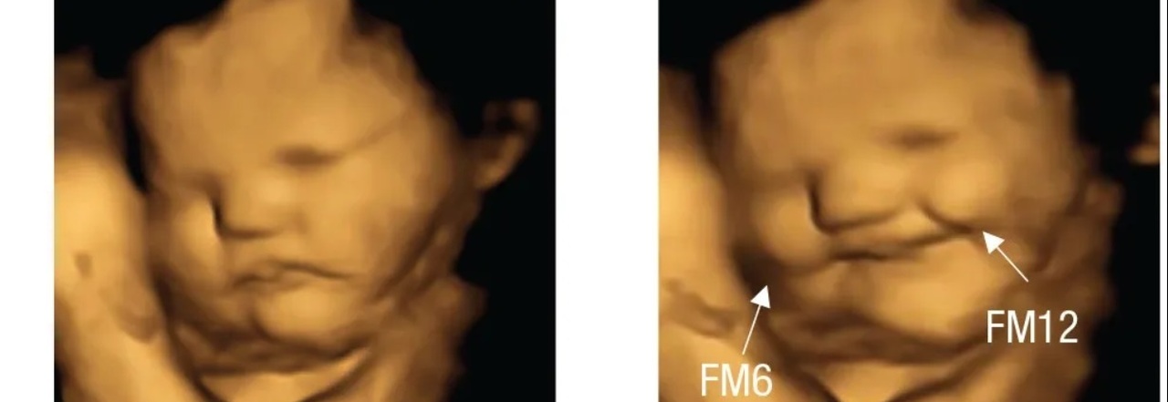 I bambini nella pancia sorridono se la mamma mangia carote e fanno una  smorfia se mangia il cavolo: la prova