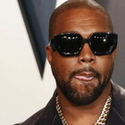 Kanye West, denti rimossi: sostituiti con una lastra in titanio, il prezzo è da capogiro