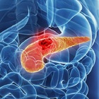 Vaccino che previene il ritorno del cancro al pancreas