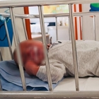 Bimbo di 2 anni figlio di vegani ricoverato in ospedale per denutrizione: è grave. «È magrissimo»