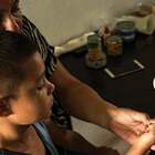 Vaccino anti-malaria approvato dall'Oms