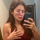 Massacrata dal marito davanti alla figlia di 4 anni: la denuncia choc di Daniela, lottatrice professionista. «Non sono riuscita a difendermi»