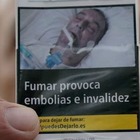 Uomo intubato sui pacchetti delle sigarette: la foto contesa