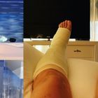 Mara Venier dopo la frattura al piede: «Domenica torno in onda con il gesso»