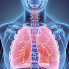 Il 30% dei guariti avrà problemi respiratori cronici. «Polmoni a rischio per sei mesi»