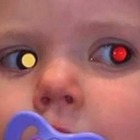 La neonata ha un cancro all'occhio, i genitori lo scoprono da una foto