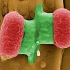 Il caso del batterio escherichia coli